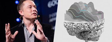 Elon Musk quiere implantar Neuralink en humanos en seis meses: es un objetivo bastante ambicioso