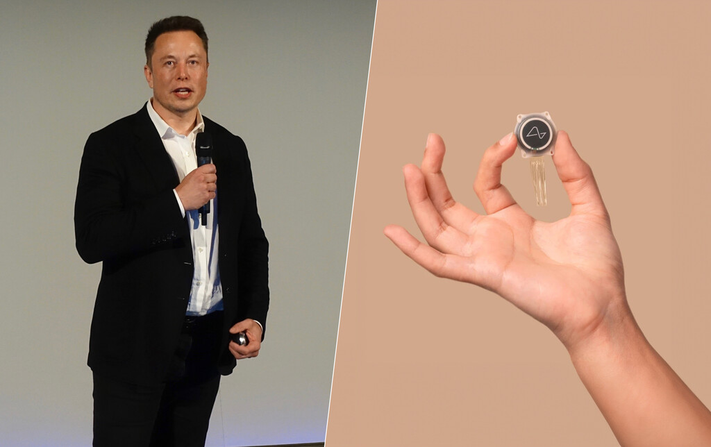 Elon Musk acaba de conseguir uno de sus objetivos más ambiciosos: el primer implante humano de Neuralink 